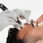 un soin nanoneedling ou microneedling Dermalogica à Bodysphere Grenoble et Vif