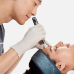 Un praticien pose un pen nanoneedling sur le front d'une cliente qui suit le soin Pro Nanoneedling de Dermalogica à Bodysphere à Crolles, Vif et Grenoble