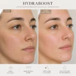 Peau éclatante après soin hydradermabrasion Bodysphere